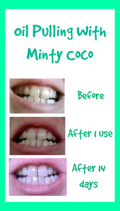 Oil Pulling With Minty Coco